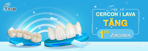 Gửi sứ Cercon | Lava tặng Zirconia